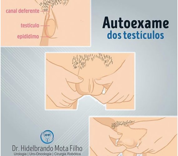 Autoexame dos testículos